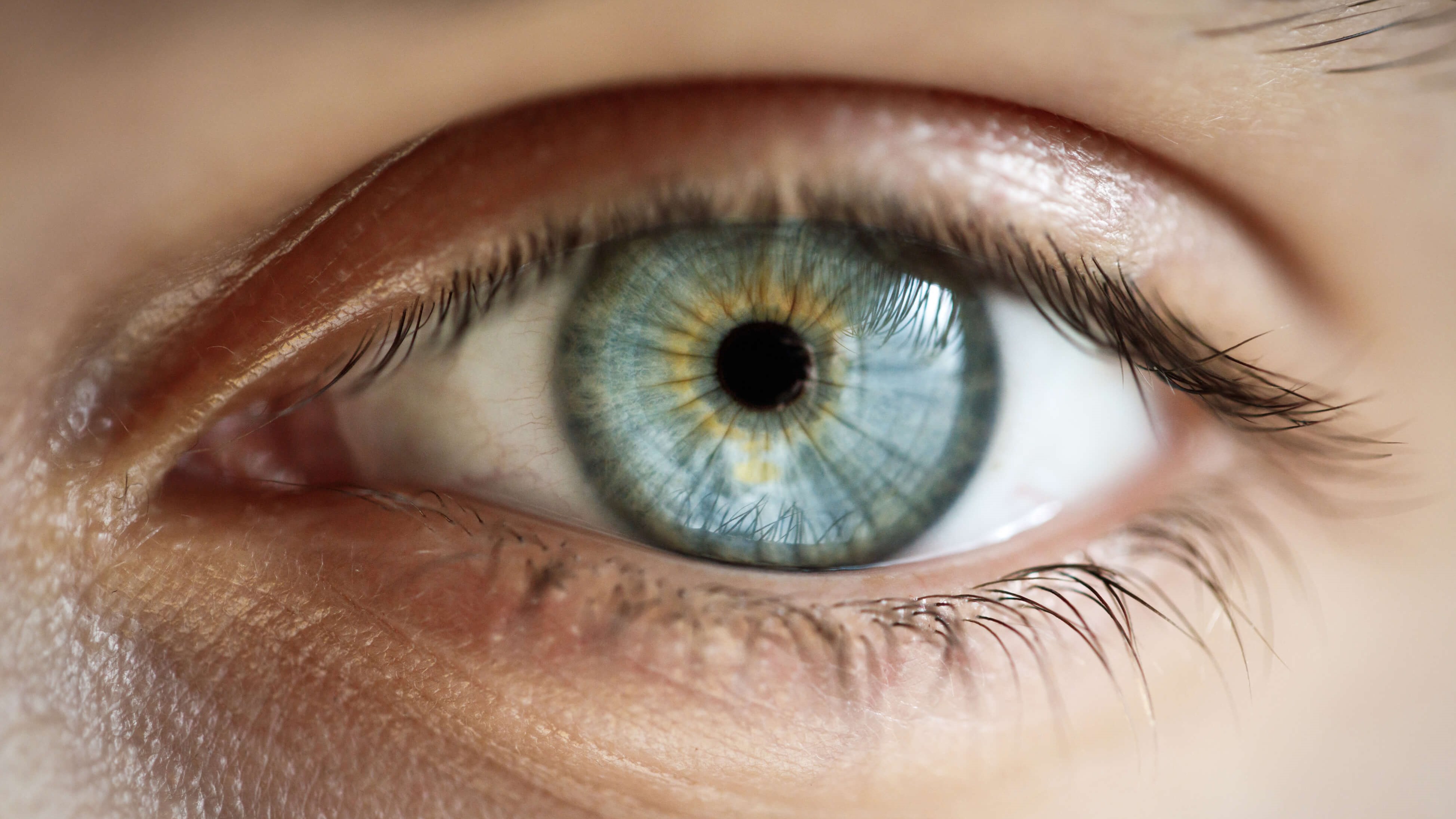 Lasik